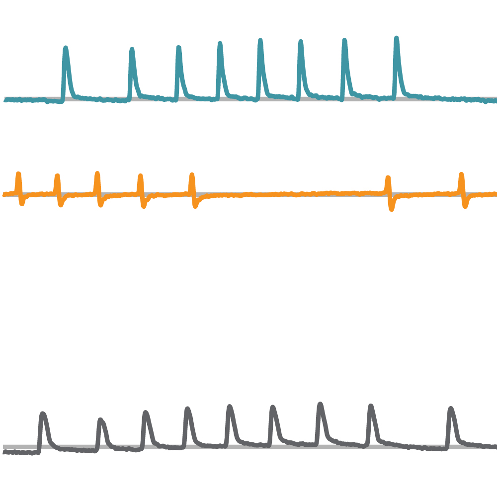 弛緩収縮評価 | Axion Biosystems